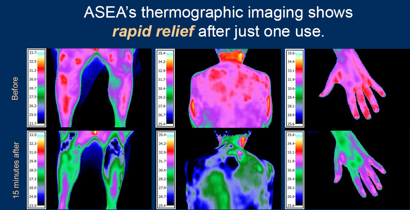 Thermographic imaging before and after using Redox Gold